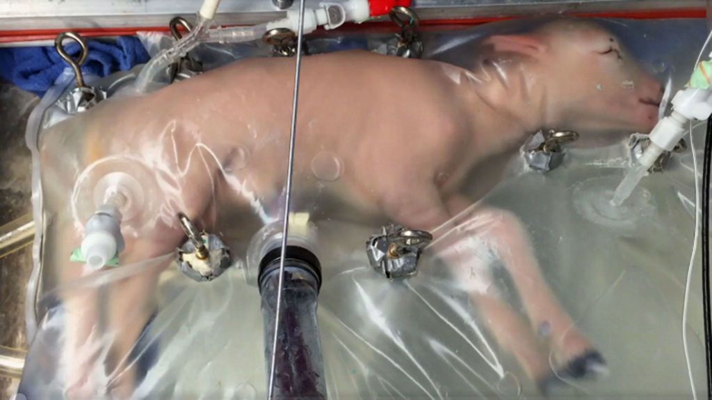 Crean un útero artificial para mantener con vida a bebés prematuros