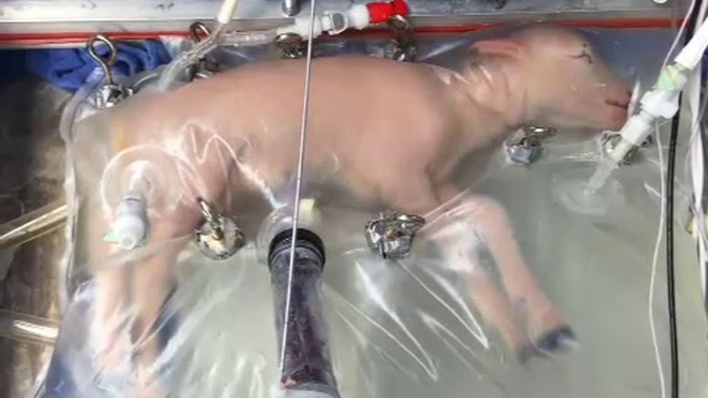 Un útero artificial para bebés prematuros