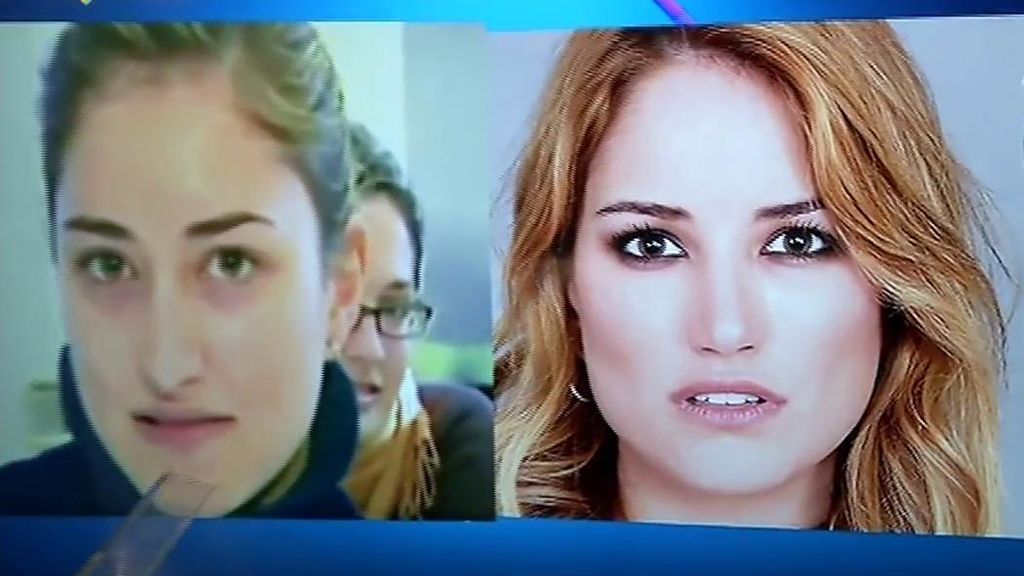 El antes y el después de Alba Carrillo: retoques en nariz 