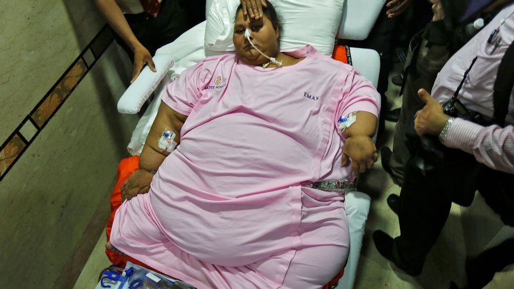 La mujer más obesa del mundo pierde 200 kilogramos tras ser operada