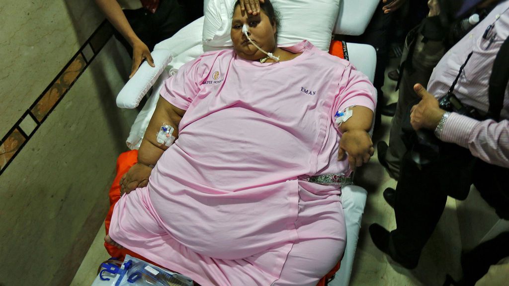 La mujer más obesa del mundo pierde 200 kilogramos tras ser operada