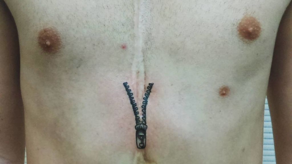 Una gran cicatriz en el pecho se convierte en una puerta a nuestro interior