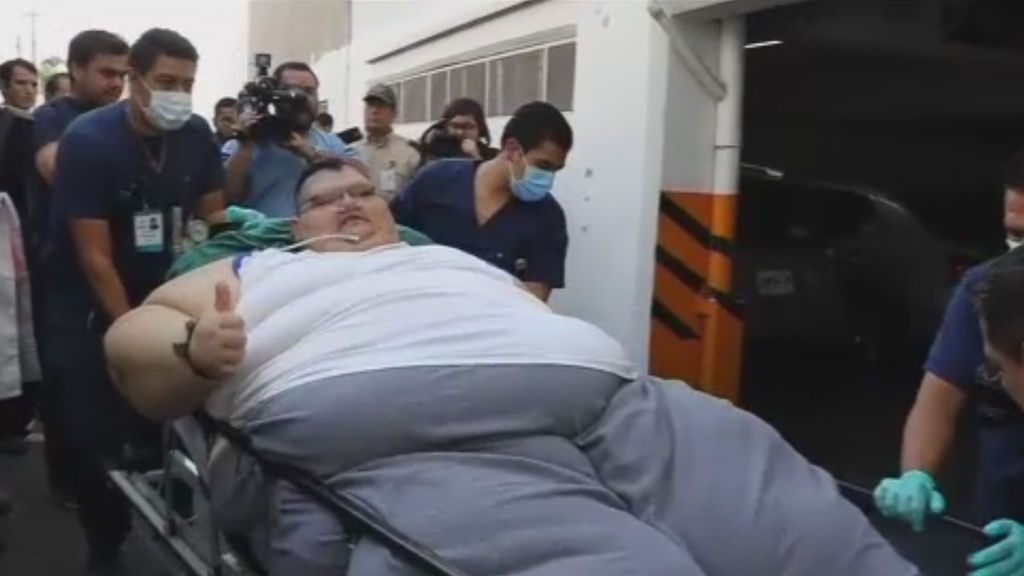 Tras su operación, el hombre más obeso del mundo perderá 175 kilos