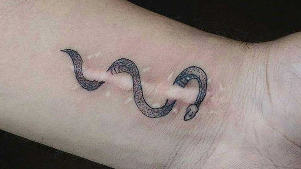 Esta serpiente se enrosca en esta cicatriz en la muñeca