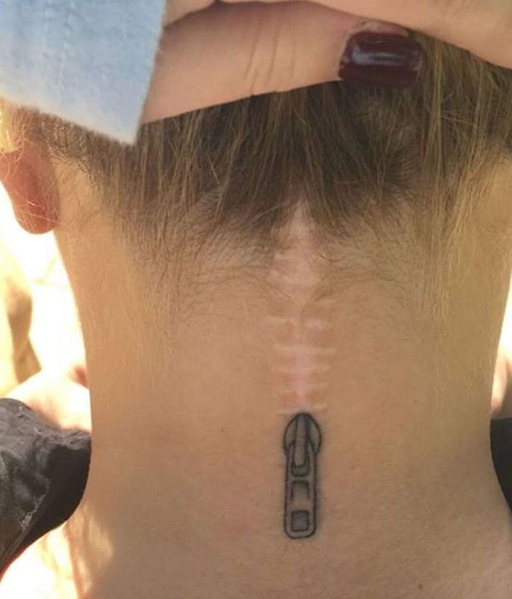 Esta cicatriz es perfecta para albergar una cremallera