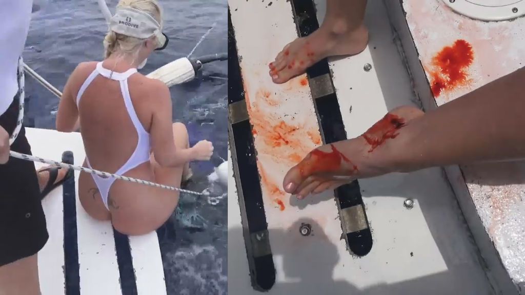 Un tiburón ataca a una actriz porno mientras grababa un vídeo promocional