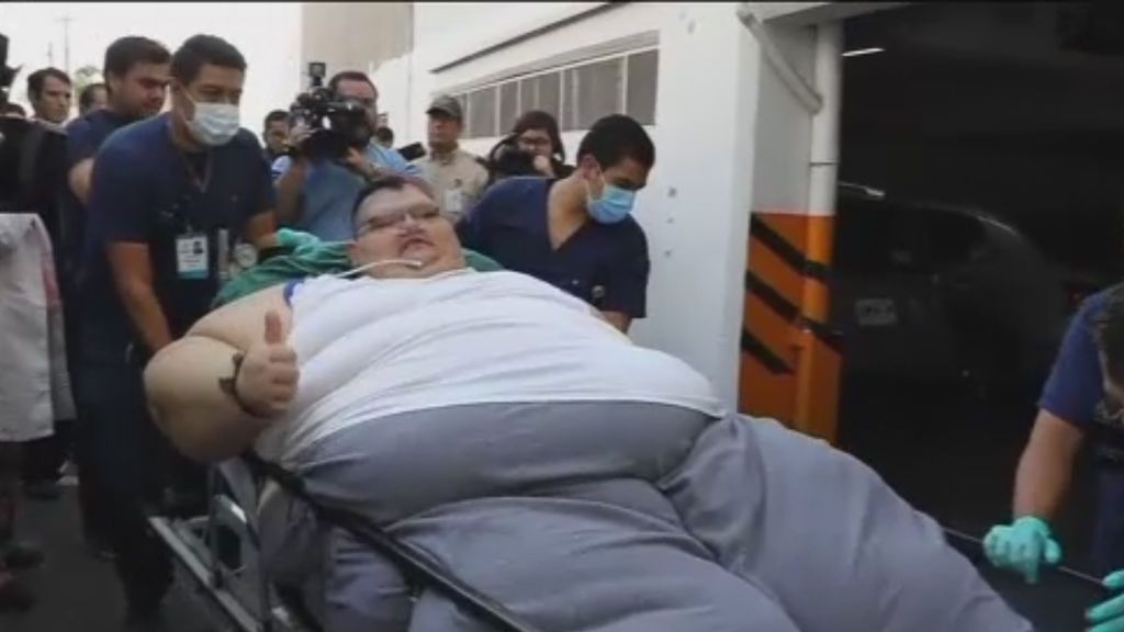 Tras su operación, el hombre más obeso del mundo perderá 175 kilos
