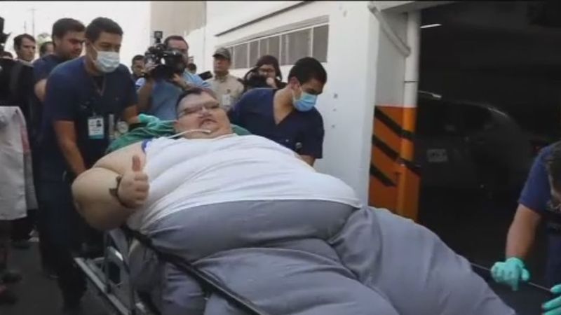 Tras su operación, el hombre más obeso del mundo perderá