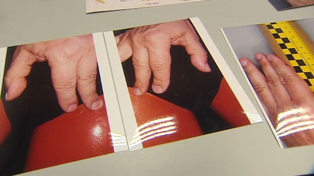 Desenmascarar a un pederasta con una nueva técnica de identificación de manos