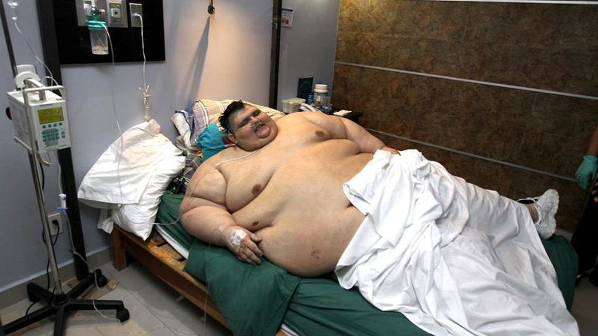 Juan Pedro Franco, el hombre más obeso del mundo, supera con éxito la operación