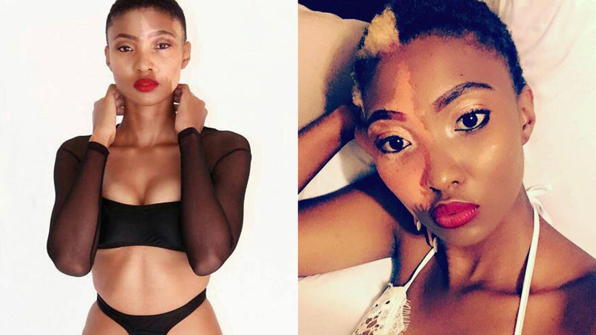 Una modelo africana con una gran marca de nacimiento desafía el concepto de belleza