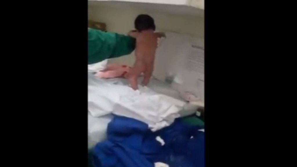 El reflejo de un recién nacido que sorprende a las enfermeras