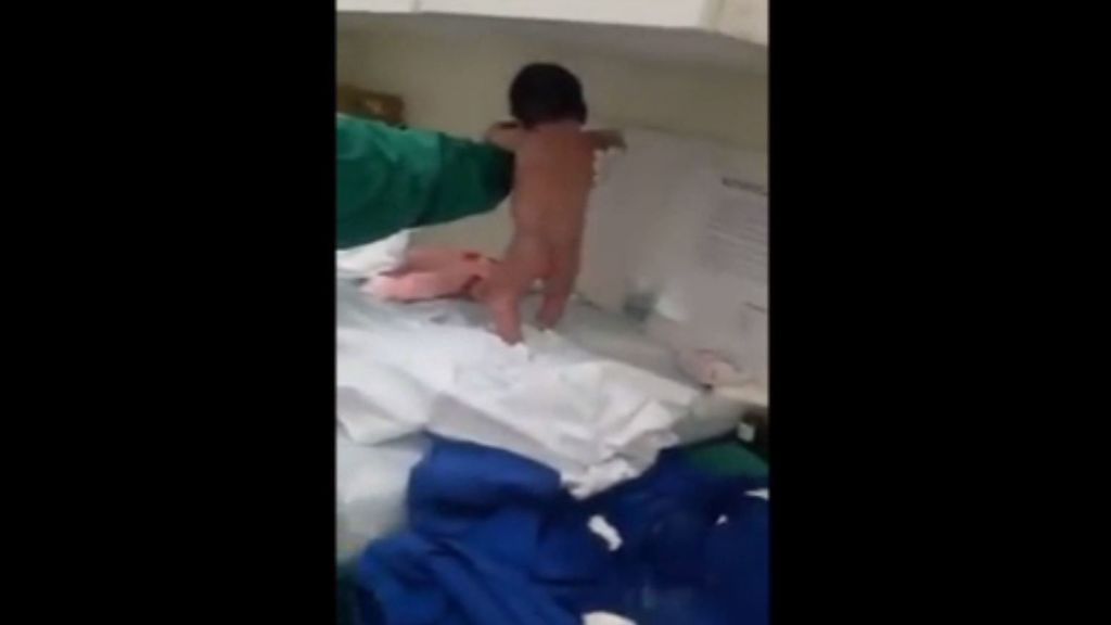 El reflejo de un recién nacido que sorprende a las enfermeras