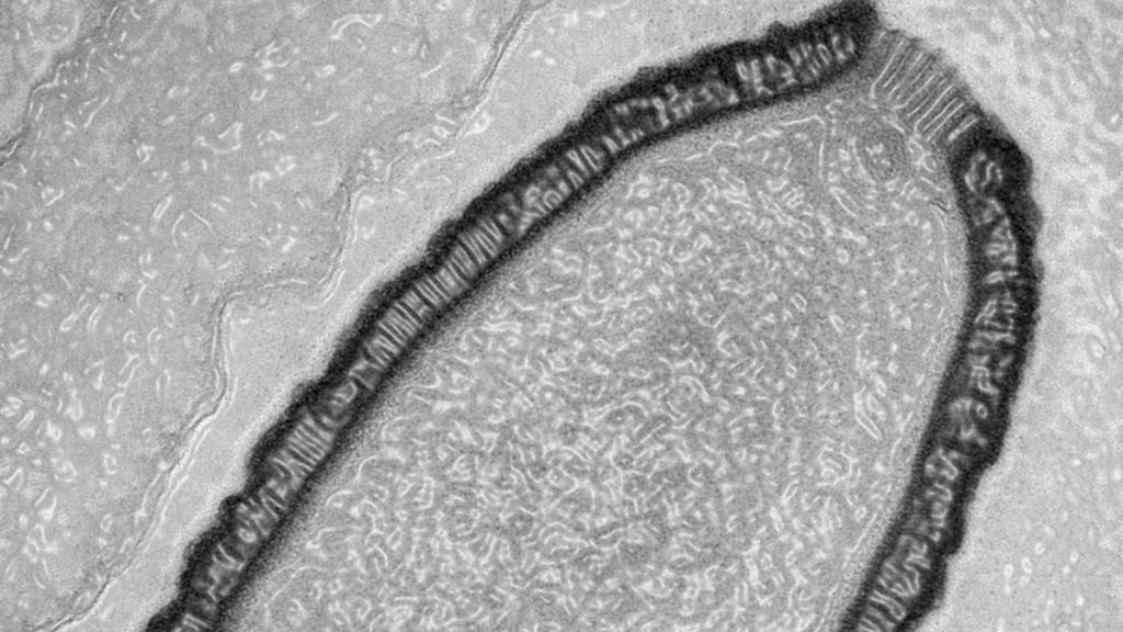 Virus 'zombies' gigantes