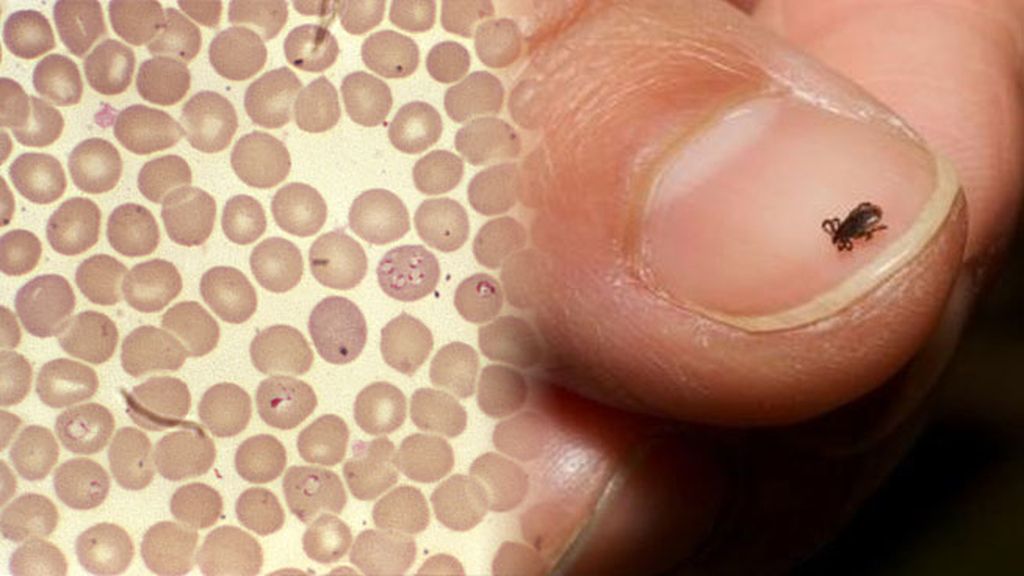 La llegada de garrapatas... y las enfermedades que traen consigo