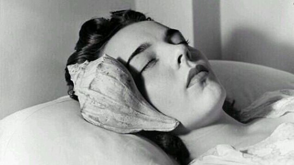 dolor cabeza