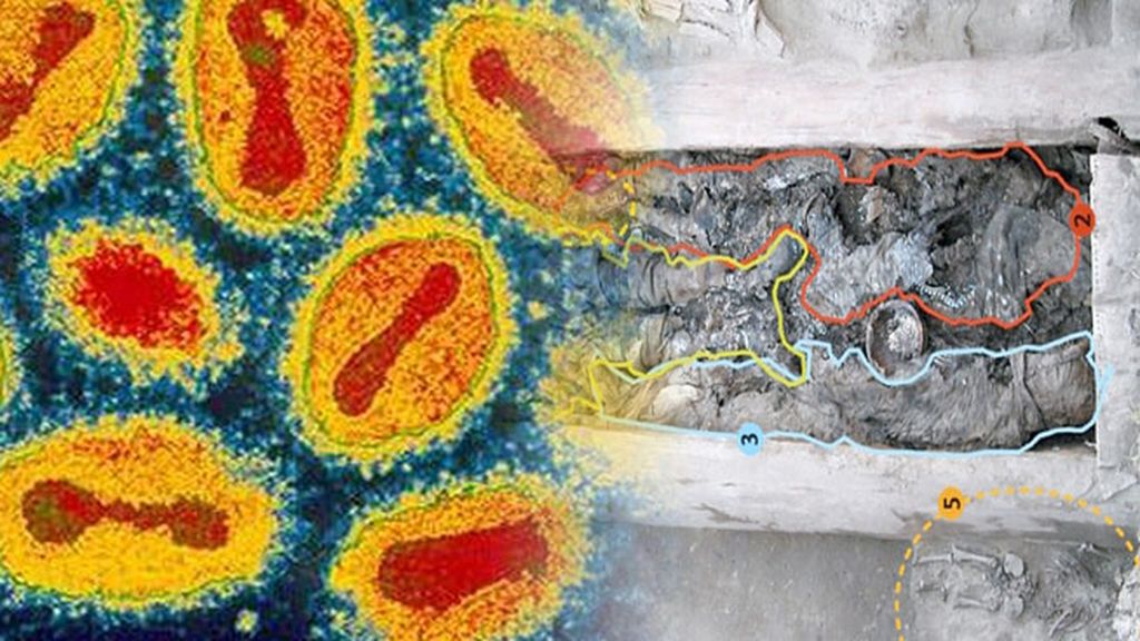 El regreso de la viruela