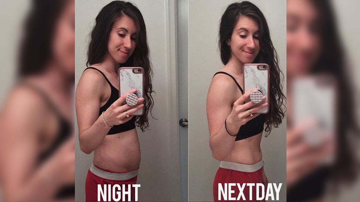 Una amante del 'fitness' muestra cómo la hinchazón abdominal trasforma su cuerpo