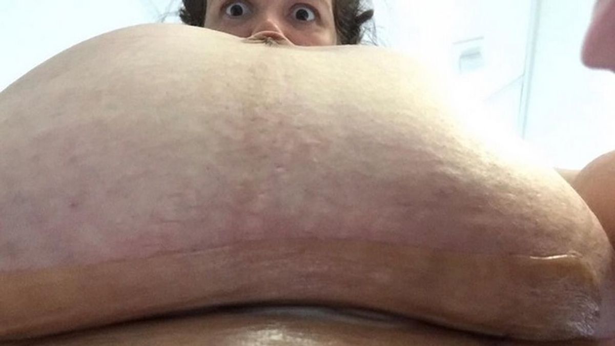 Publica una foto de su tripa cuatro días después de dar a luz a su bebé por cesárea
