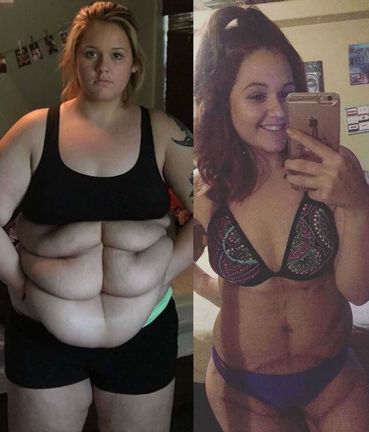 Una joven se compra su primer bikini tras perder 76 kilos de exceso de piel