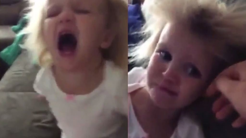 El raro 'Síndrome del cabello impeinable' que afecta a 100 niños en todo el mundo