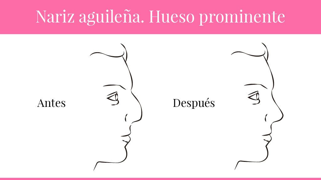 narices-06