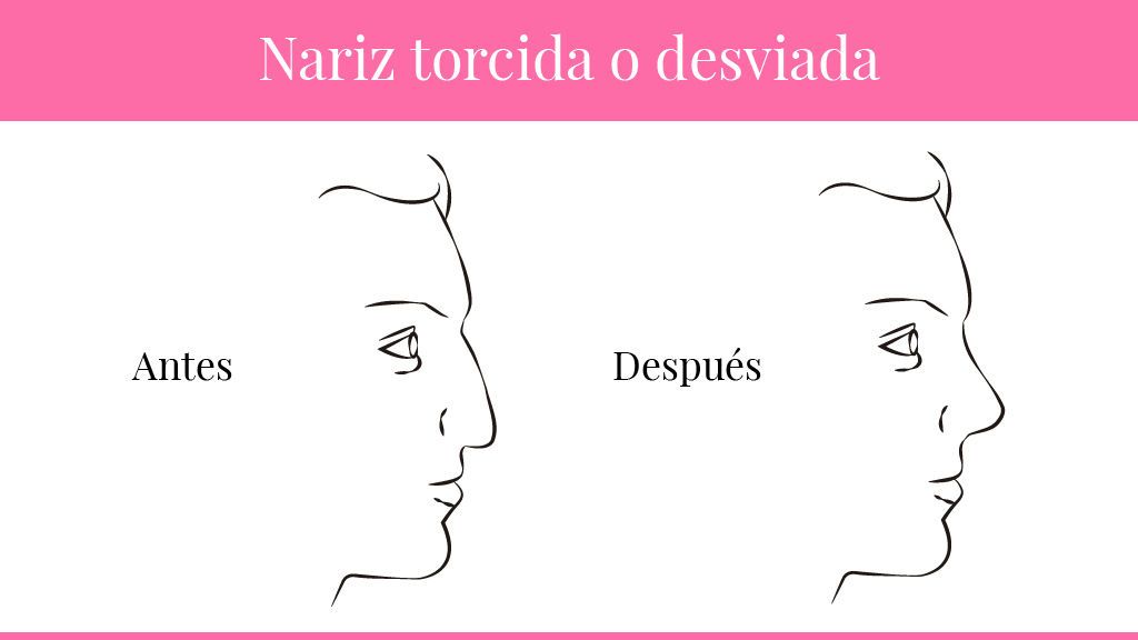 narices-02