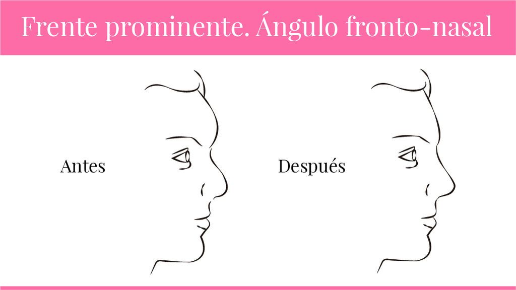 narices-07