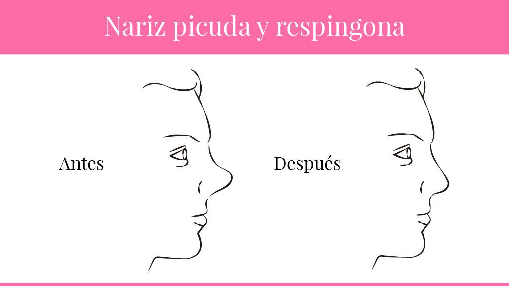 narices-05