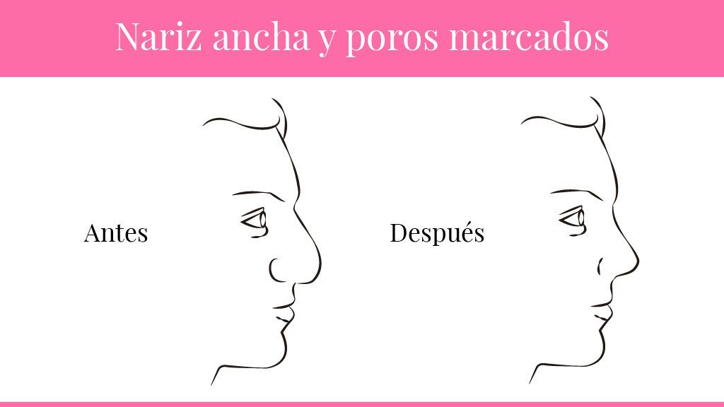 narices-04