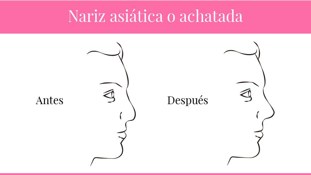 asiáticas o achatadas