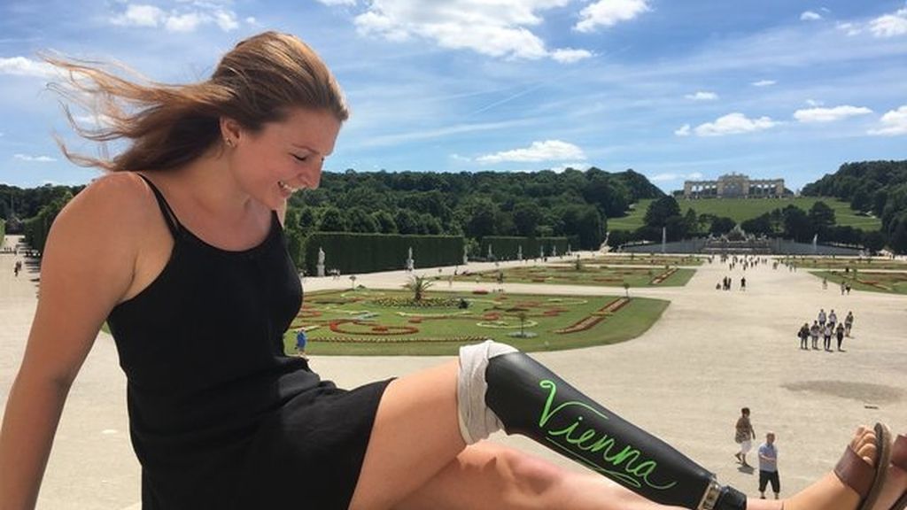 La pierna ortopédica de esta joven es la protagonista de todos sus viajes