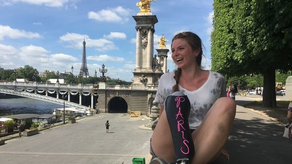 La pierna ortopédica de esta joven es la protagonista de todos sus viajes