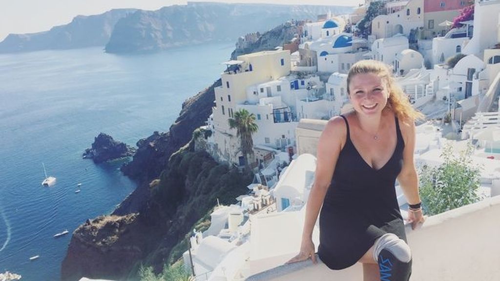 La pierna ortopédica de esta joven es la protagonista de todos sus viajes