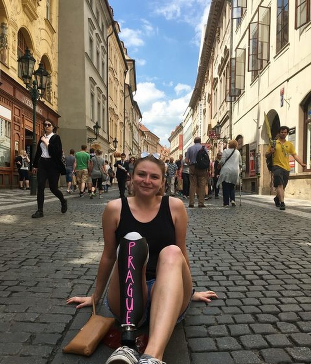 La pierna ortopédica de esta joven es la protagonista de todos sus viajes