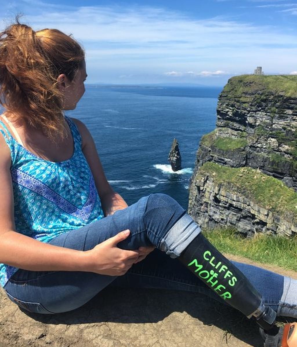 La pierna ortopédica de esta joven es la protagonista de todos sus viajes