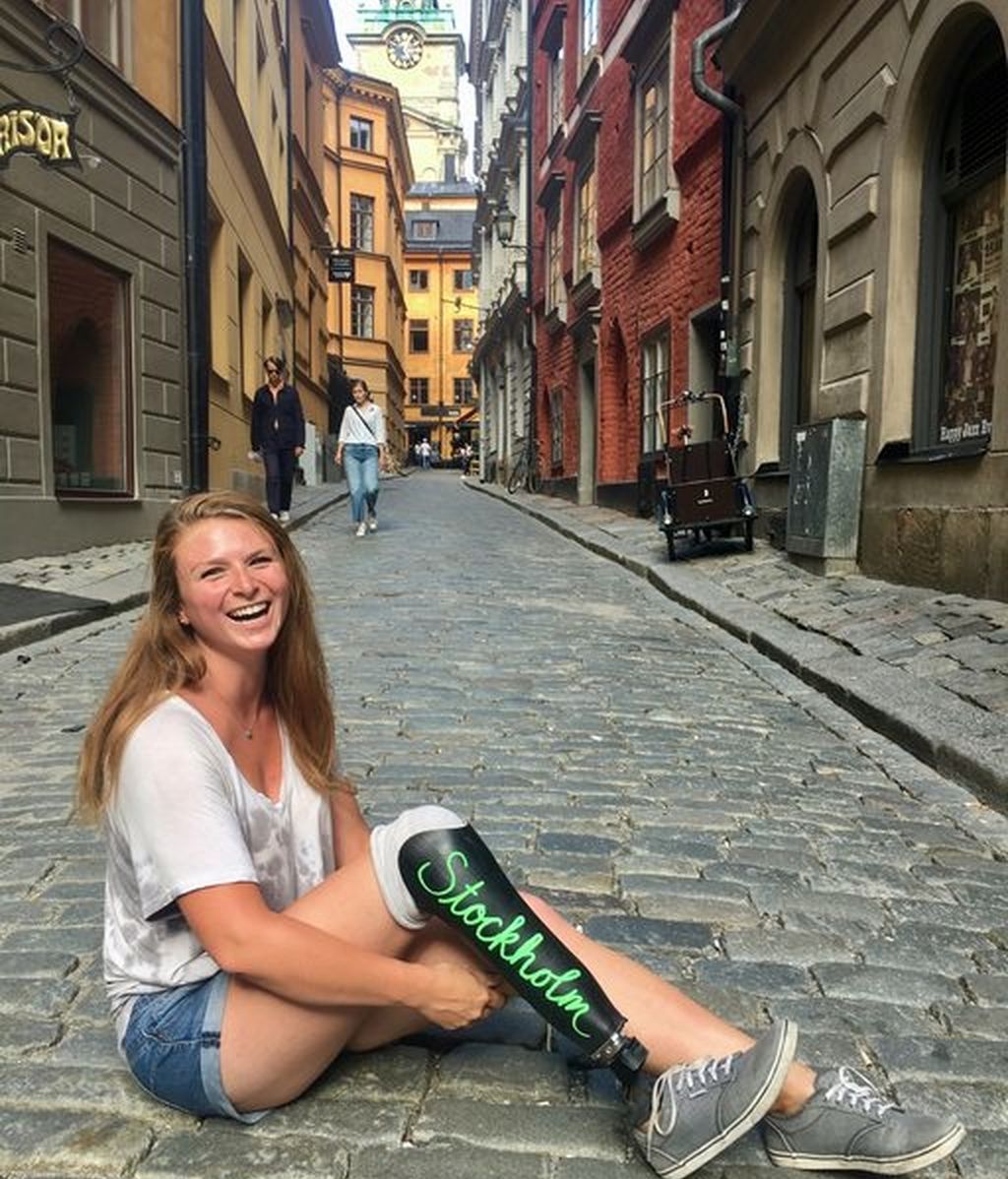 La pierna ortopédica de esta joven es la protagonista de todos sus viajes