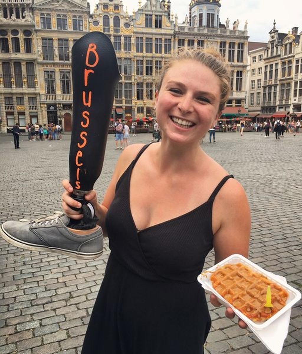 La pierna ortopédica de esta joven es la protagonista de todos sus viajes