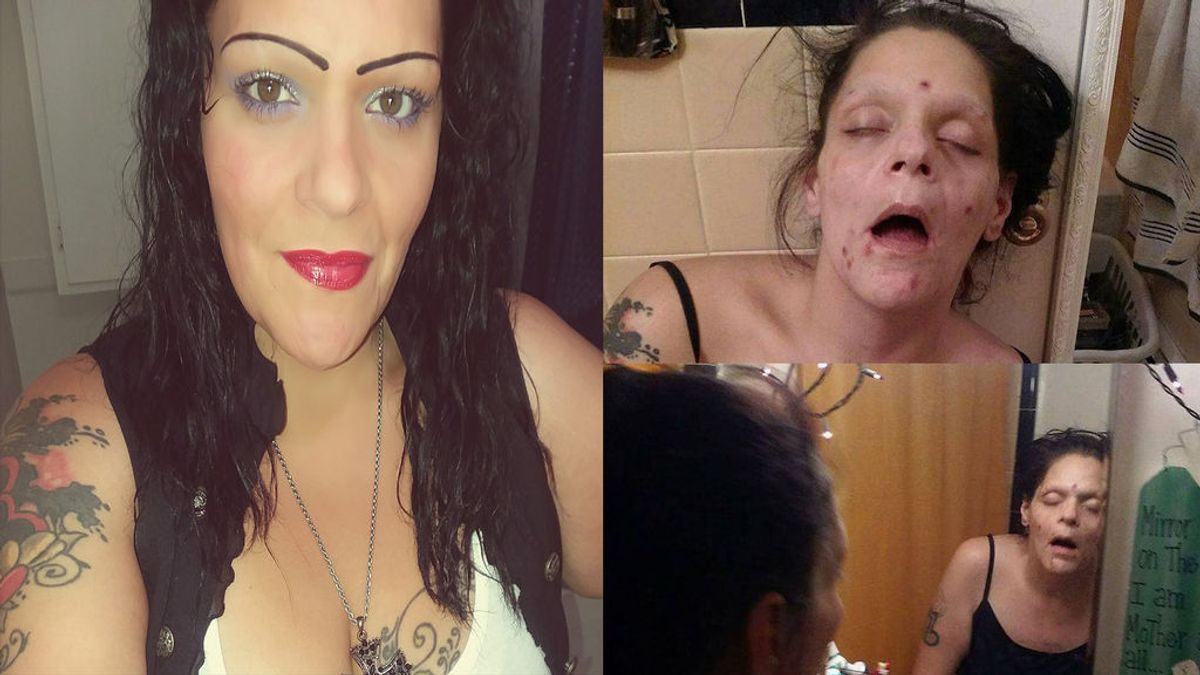 Una mujer comparte en Facebook su impactante aspecto cuando era adicta a la heroína