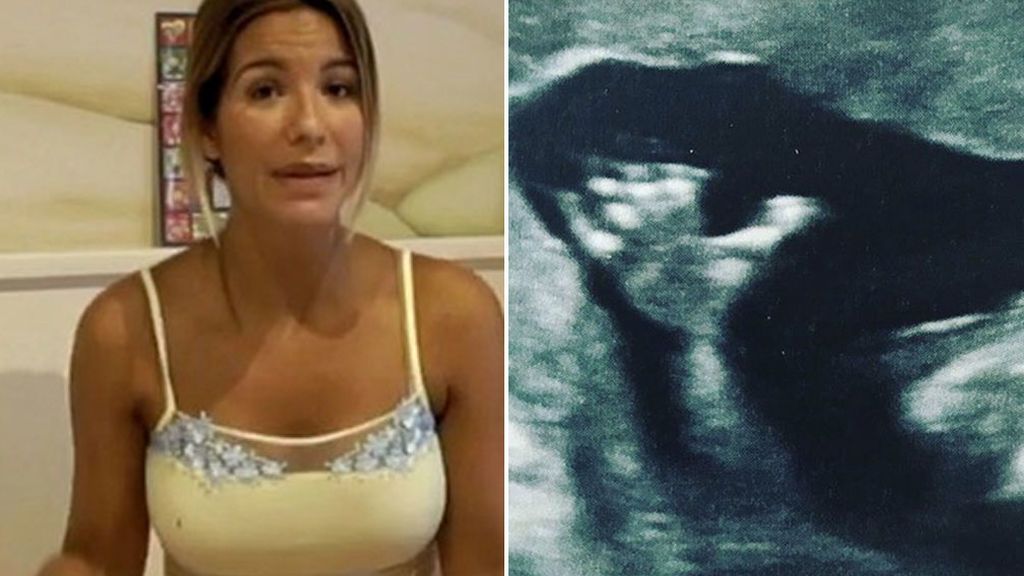 Tamara Gorro comparte una ecografía de su bebé: "Dentro de poco nos vemos"