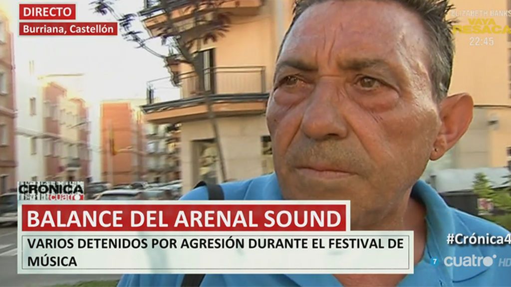Supuestos agredidos en el festival Arenal Sound, muestran sus heridas