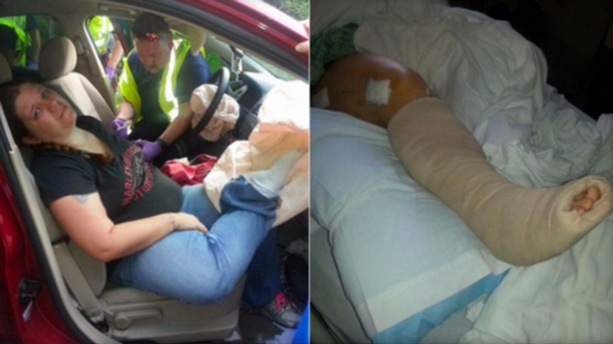 Una mujer advierte de los riesgos de poner los pies en el salpicadero del coche tras una accidente