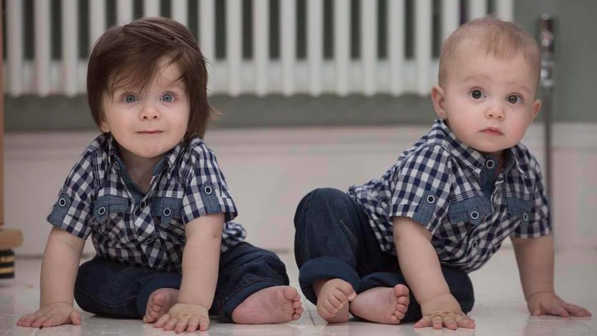 La diferencia entre estos gemelos que no se aprecia a simple vista