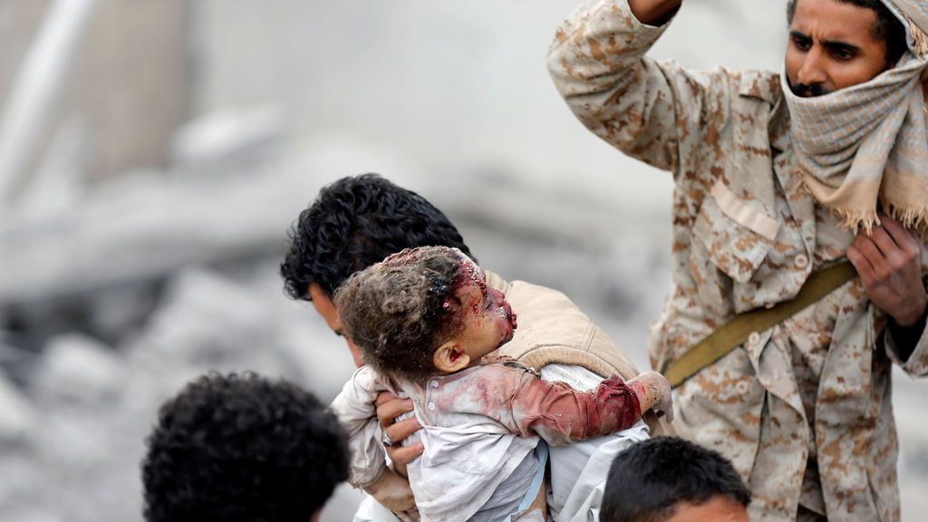 Bombardeo en Sanaa, Yemen