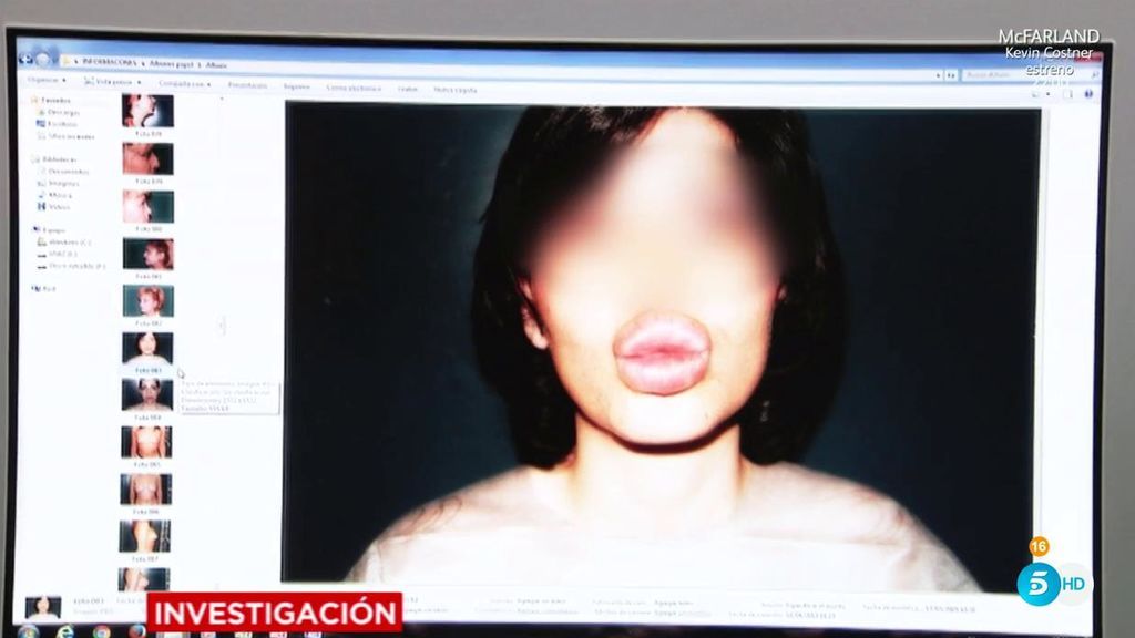 'AR Investigación': las graves consecuencias del bisturí 'low cost'