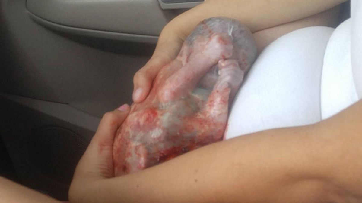 El “milagroso” parto de un bebé prematuro en un coche envuelto en el saco amniótico