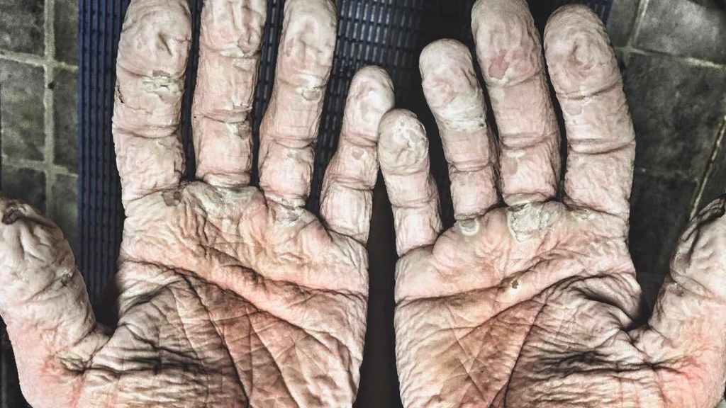 La impresionante imagen de las consecuencias de ser doble oro olímpico en remo