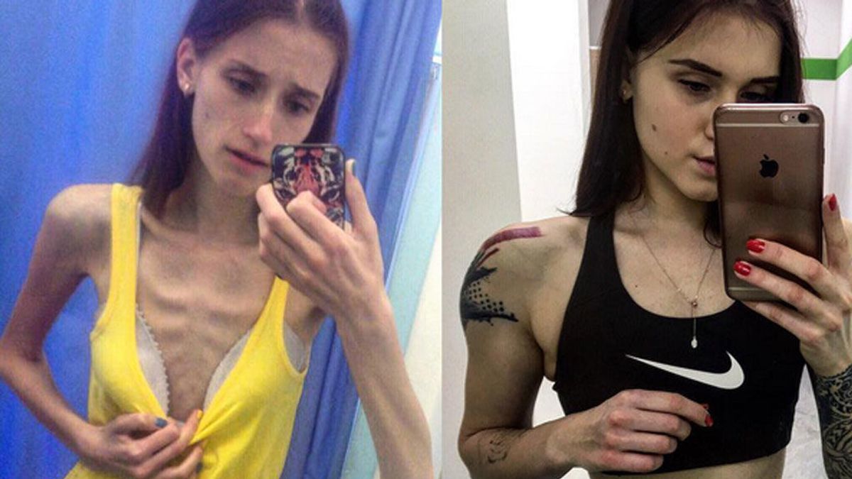 Recuperada de anorexia, se convierte en instructora de fitness