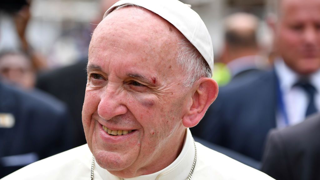 El papa Francisco se golpea con el papamóvil al saludar a un fiel en Colombia