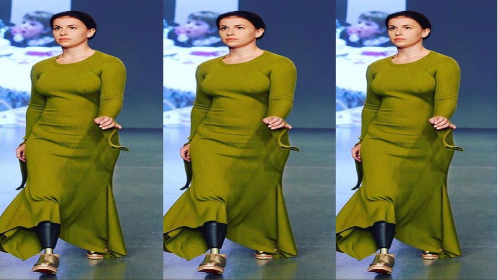 Una modelo, 'víctima' de Alton Towers, muestra orgullosa su prótesis en la pasarela